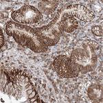 FBXL8 Antibody in Immunohistochemistry (Paraffin) (IHC (P))