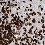 MARS2 Antibody in Immunohistochemistry (Paraffin) (IHC (P))