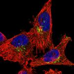 RASGEF1A Antibody in Immunocytochemistry (ICC/IF)