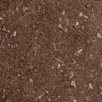 RASGEF1A Antibody in Immunohistochemistry (Paraffin) (IHC (P))