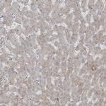 RASGEF1A Antibody in Immunohistochemistry (IHC)