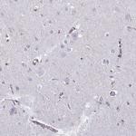 TRH Polyclonal Antibody