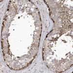 MAP7D3 Polyclonal Antibody