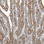 OTOP1 Antibody in Immunohistochemistry (Paraffin) (IHC (P))