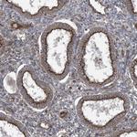 OTOP1 Antibody in Immunohistochemistry (Paraffin) (IHC (P))
