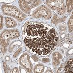 OTOP1 Antibody in Immunohistochemistry (Paraffin) (IHC (P))