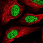 SCAF8 Polyclonal Antibody