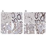 SCAF8 Antibody in Immunohistochemistry (IHC)