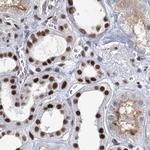 SCAF8 Antibody in Immunohistochemistry (IHC)