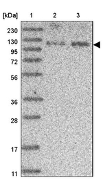 SCAF8 Antibody in Western Blot (WB)