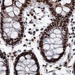 SCAF8 Antibody in Immunohistochemistry (IHC)