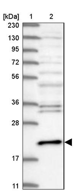 Centrin 3 Antibody in Western Blot (WB)