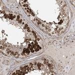 Centrin 3 Antibody in Immunohistochemistry (IHC)
