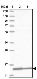 Profilin 2 Antibody in Western Blot (WB)