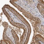 CNOT10 Polyclonal Antibody