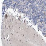GABRG1 Antibody in Immunohistochemistry (Paraffin) (IHC (P))