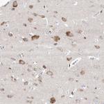 GABRG1 Antibody in Immunohistochemistry (Paraffin) (IHC (P))