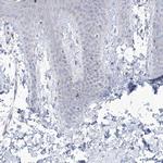 GABRG1 Antibody in Immunohistochemistry (Paraffin) (IHC (P))