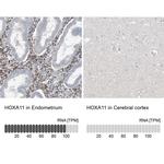 HOXA11 Polyclonal Antibody