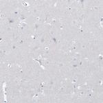 B3GNT7 Antibody in Immunohistochemistry (Paraffin) (IHC (P))