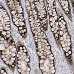 B3GNT7 Antibody in Immunohistochemistry (Paraffin) (IHC (P))