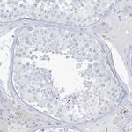 B3GNT7 Antibody in Immunohistochemistry (Paraffin) (IHC (P))