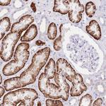 SLC4A4 Polyclonal Antibody