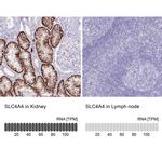 SLC4A4 Antibody in Immunohistochemistry (IHC)