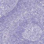 SLC4A4 Antibody in Immunohistochemistry (IHC)