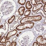 SLC4A4 Polyclonal Antibody