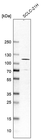 AARS2 Antibody in Western Blot (WB)