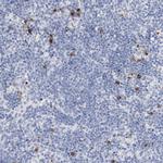 PAFAH1B3 Antibody in Immunohistochemistry (Paraffin) (IHC (P))