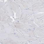 PAFAH1B3 Antibody in Immunohistochemistry (Paraffin) (IHC (P))