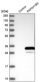 PAFAH1B3 Antibody in Western Blot (WB)