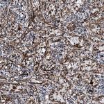 DPEP2 Polyclonal Antibody