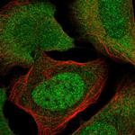 TIGD4 Polyclonal Antibody