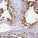 TIGD4 Antibody in Immunohistochemistry (Paraffin) (IHC (P))