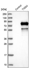 TIGD4 Antibody in Western Blot (WB)