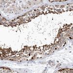 PCDHA2 Antibody in Immunohistochemistry (Paraffin) (IHC (P))
