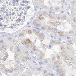 CSN1S1 Antibody in Immunohistochemistry (IHC)