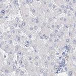 CSN1S1 Antibody in Immunohistochemistry (IHC)