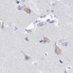 CSN1S1 Antibody in Immunohistochemistry (IHC)