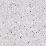 TMEM132B Polyclonal Antibody