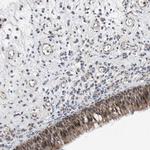 TMEM132B Polyclonal Antibody