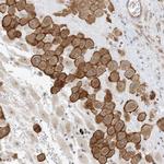 IL36B Polyclonal Antibody