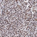 PCDHA3 Polyclonal Antibody