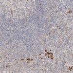 CLNK Polyclonal Antibody