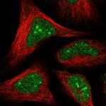 HDDC2 Antibody in Immunocytochemistry (ICC/IF)