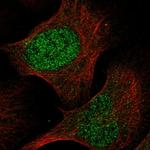 RPP40 Polyclonal Antibody