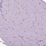 RFX3 Antibody in Immunohistochemistry (Paraffin) (IHC (P))